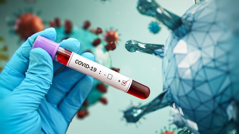 Vengrijoje per pastarąją parą užfiksuotas rekordinis naujų COVID-19 atvejų skaičius