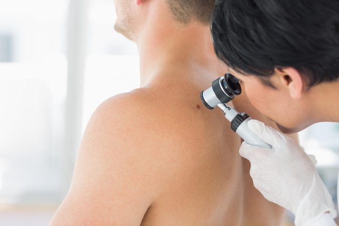 Proveržis melanomos gydyme: naujas vaistas aprobuotas pagreitinta tvarka