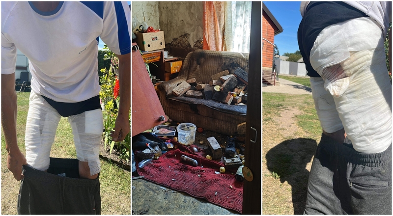 Kraupus įvykis Marijampolės apskrityje: į namus įsiveržę chuliganai padegė vyrą