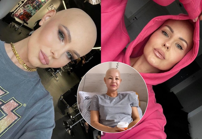 Po trečio chemoterapijos kurso I. Burlinskaitė grįžo namo: pranešė, kaip jaučiasi