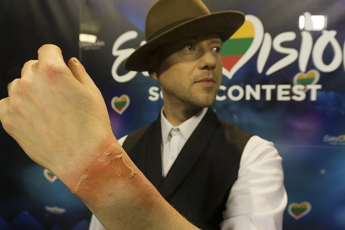 Nesėkmingas triukas: „Eurovizijos“ scenoje Sasha Song apdegė ranką