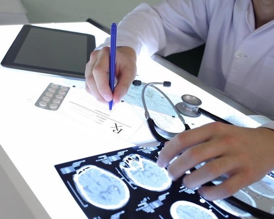 Neurologai: epilepsijos priepuolius padeda įveikti dieta