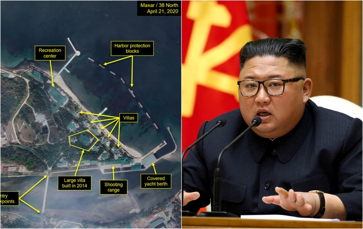 Kim Jong Unas