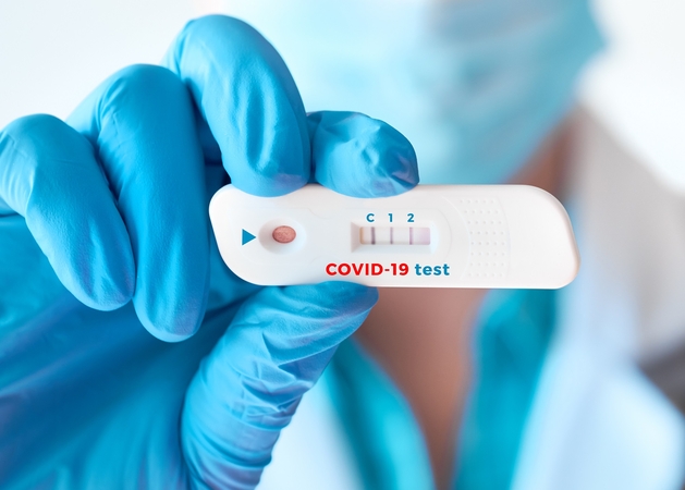 NVSPL pasirašė sutartį dėl 300 tūkst. greitųjų COVID-19 antigenų testų įsigijimo