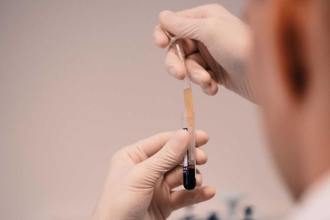 Gydytoja pulmonologė įvardija tuberkuliozės simptomus