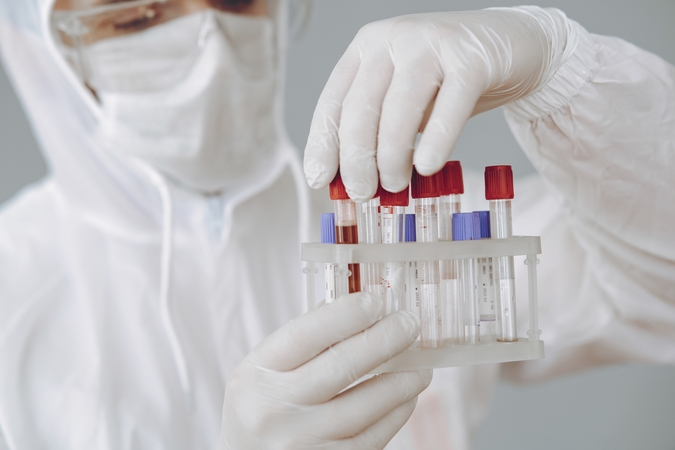 NVSPL turi 180,8 tūkst. serologinių greitųjų testų, daugiau įsigyti kol kas neplanuojama