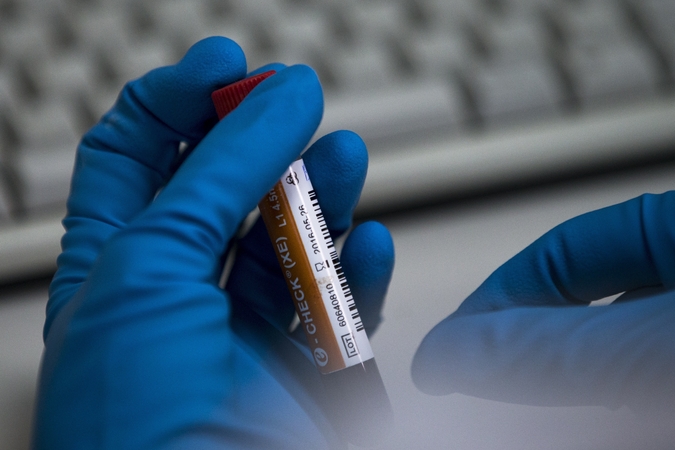 WADA: COVID-19 pandemija galėjo pakenkti kovai už „švarų sportą“