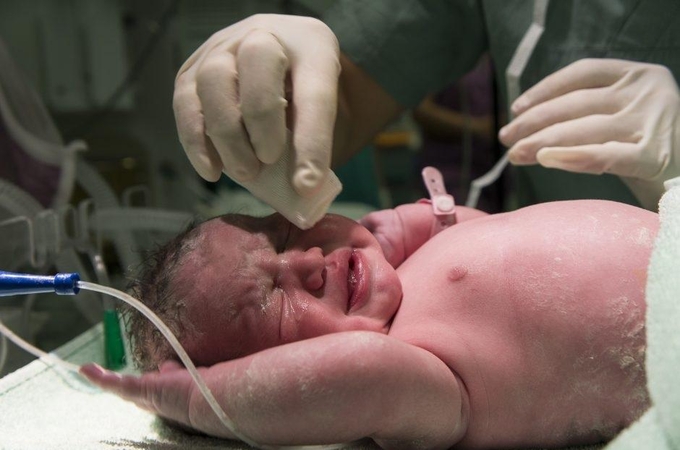 Gimdymas per karantiną: kaukė privaloma ir gimdančiai moteriai