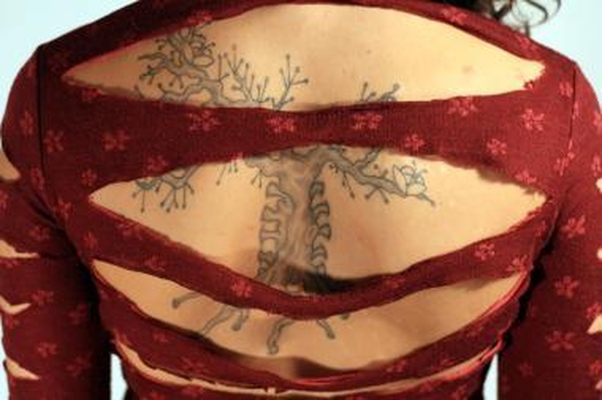 Saugus būdas atsikratyti tatuiruotės