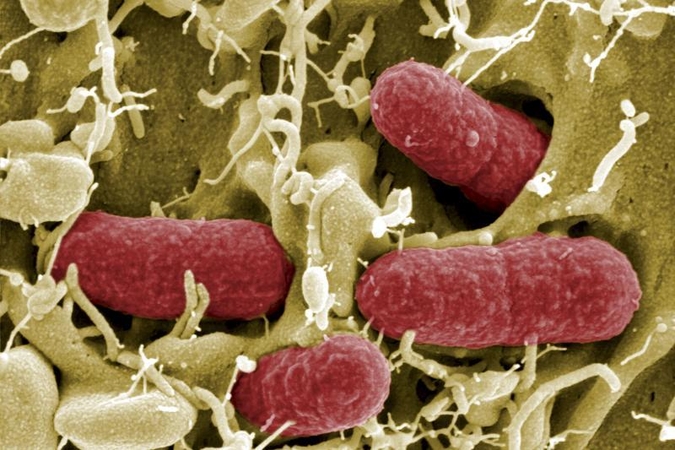 Izoliuotame N.Meksikos urve aptikta antibiotikams atsparių bakterijų