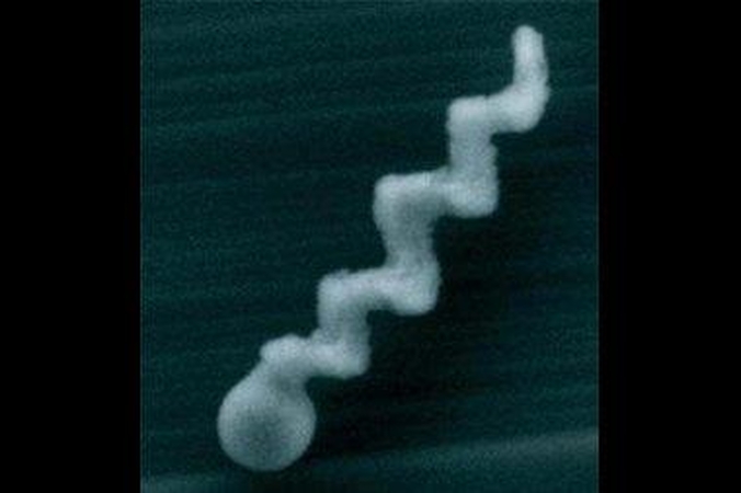 Vaistus žmogaus kūne gabens nanorobotai