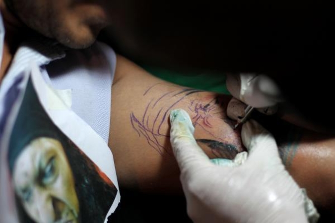 Vokietijoje gydytojas atsisakė operuoti pacientą su nacių tatuiruote