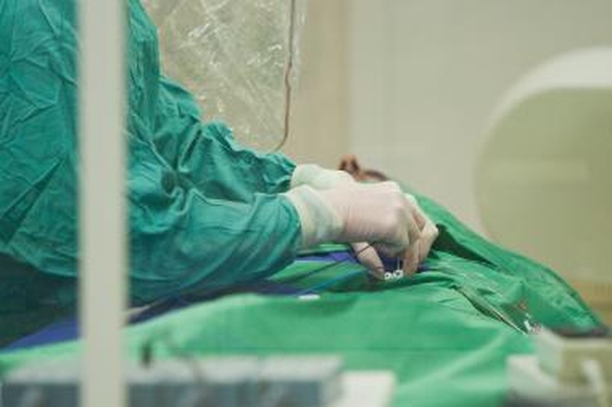 Skrodimas – be chirurginės intervencijos