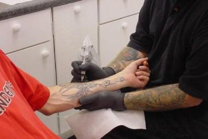 Tatuiruotes šalina galingas lazeris