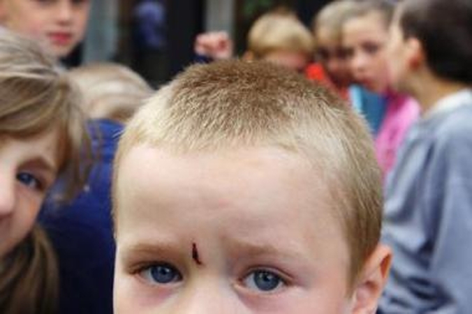 Už vaikui nusuktą ausį – į kalėjimą (papildyta)